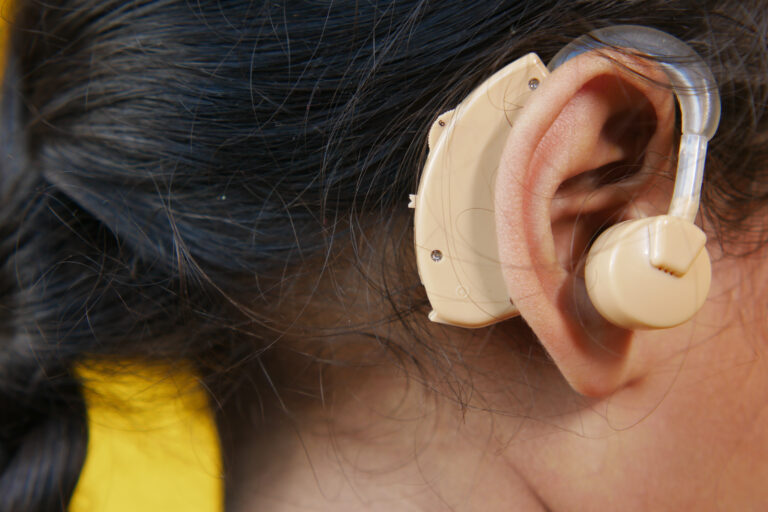 Close-up of a behind-the-ear assistive listening device worn by a young girl with dark hair, showing the earmold and hearing aid casing.